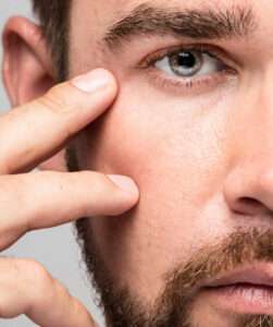 cirugia de parpados en guadalajara cirujano plastico en guadalajara