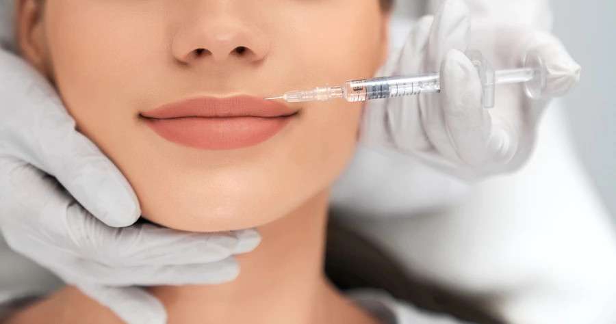 Fillers faciales, ¿Qué son?