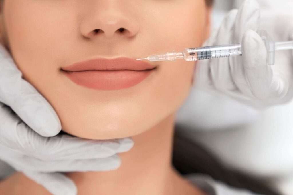 Facial fillers